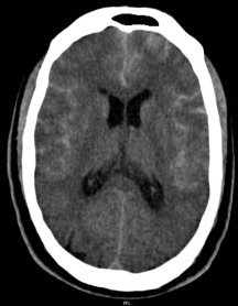 Active Image